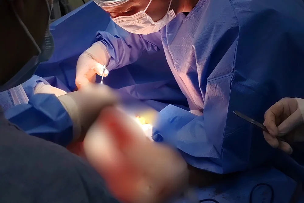 Plastia inguinal en Veracruz